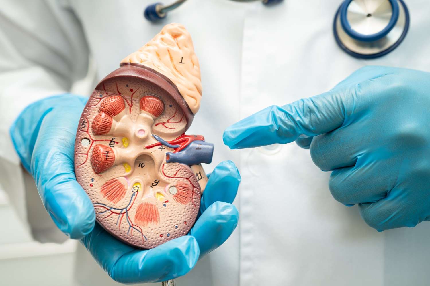 Gallbladder Stones Treatment